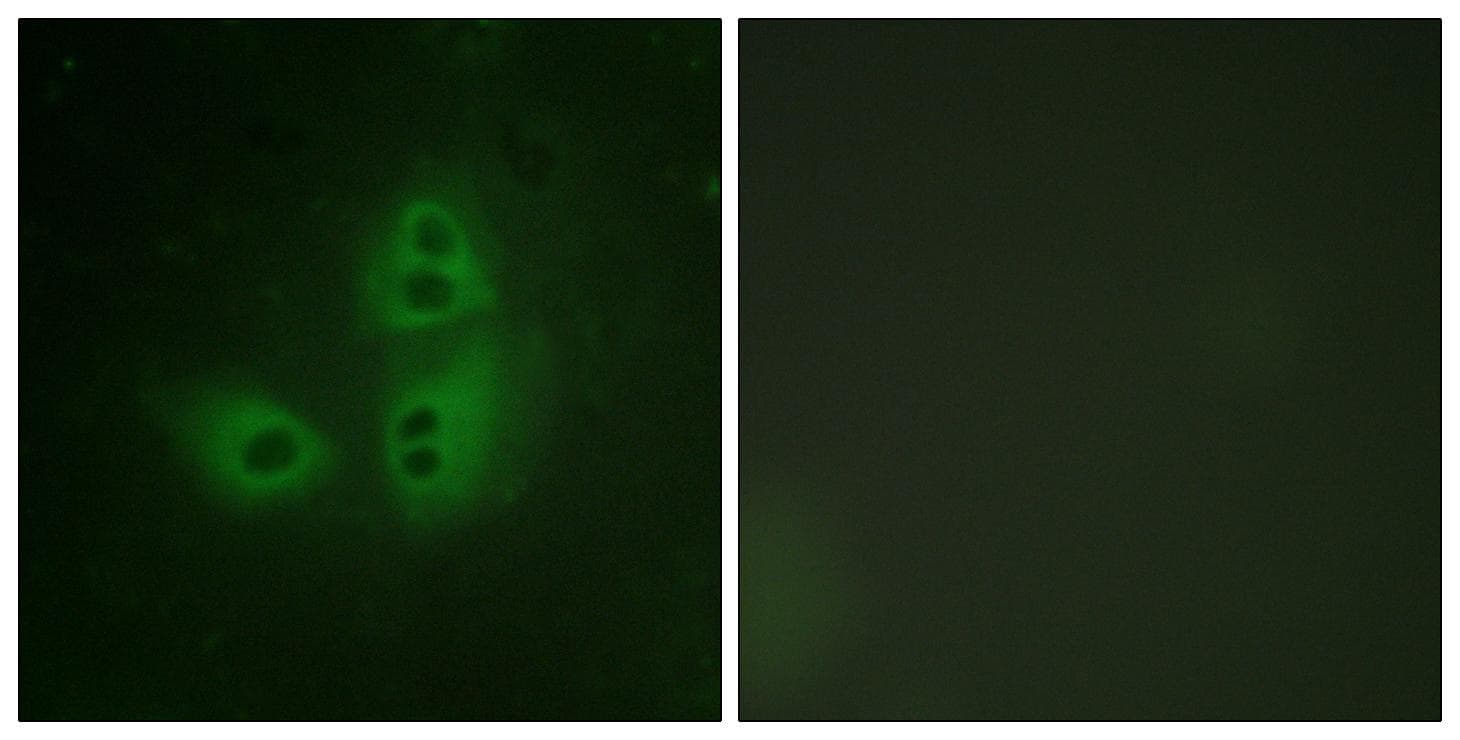 Polyclonal Rabbit anti-Human NOS1 / nNOS Antibody (p852, IF, WB)