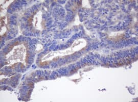 CYP2J2 Antibody (clone OTI5C9)
