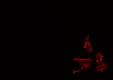 ADCY4 / Adenylate Cyclase 4 Antibody