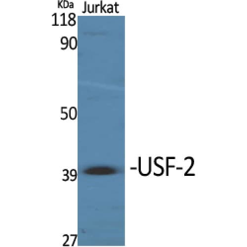 Polyclonal Rabbit anti-Human USF2 Antibody (170-250 aa, Internal, IHC, WB)