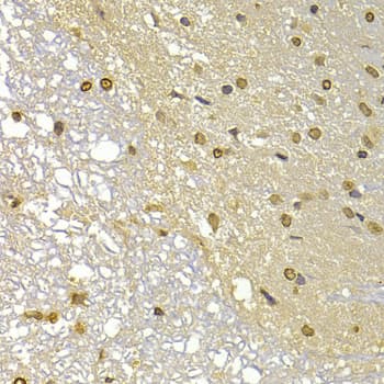 S100A4 / FSP1 Antibody