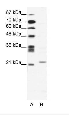 Polyclonal Rabbit anti-Human TWIST1 / TWIST Antibody (C-Terminus, WB)