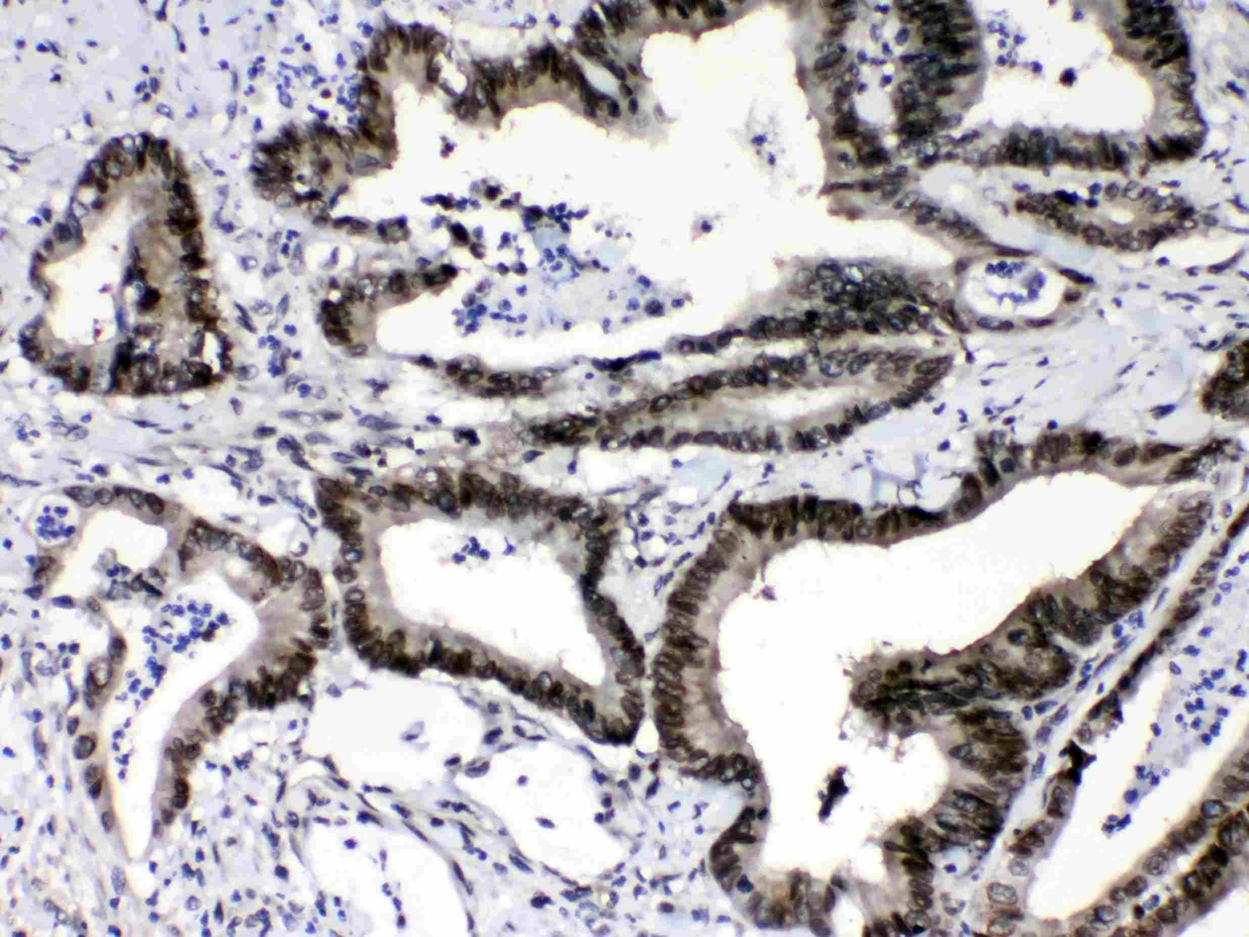 RAN Antibody