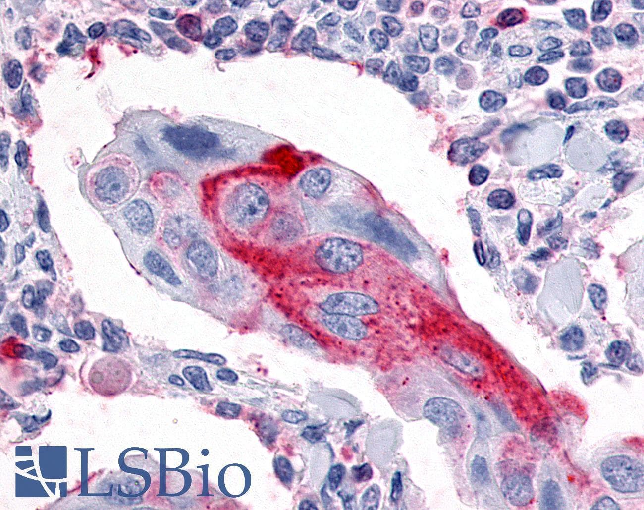PathPlus™ Polyclonal Rabbit anti-Human ESRRG / ERR Gamma Antibody (C-Terminus, IHC, WB)