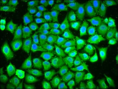 POLDIP3 / p46 Antibody
