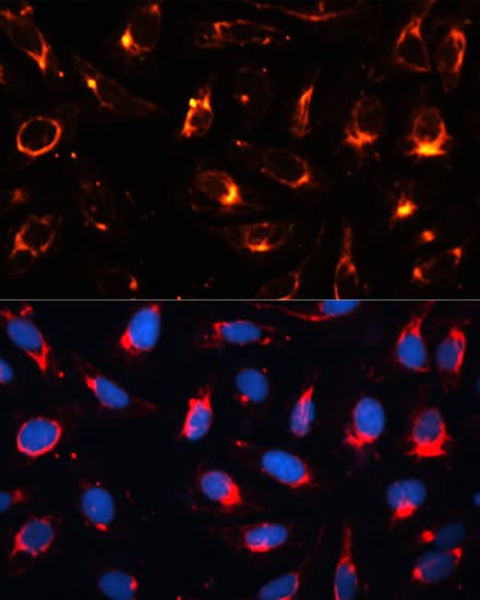 KRT18 / CK18 / Cytokeratin 18 Antibody