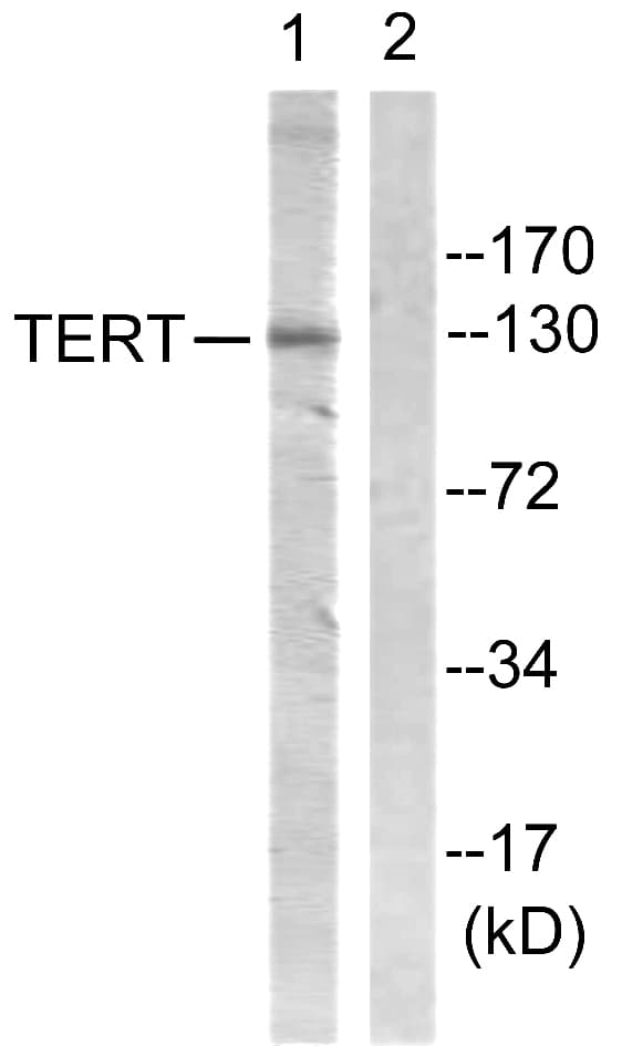 Polyclonal Rabbit anti-Human TERT / Telomerase Antibody (aa796-845, WB)