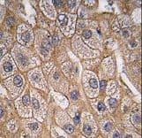 Polyclonal Rabbit anti-Human SH3GLB1 / Bif / Endophilin B1 Antibody (Tyr80, IHC, WB)