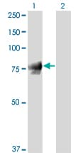 IHC-plus™ Monoclonal Mouse anti-Human JUP/CTNNG/Junction Plakoglobin Antibody (clone 2G9, IHC, IF, WB)