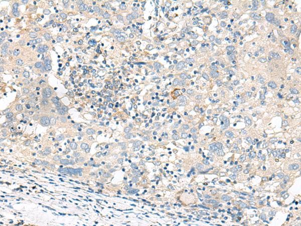 Polyclonal Rabbit anti-Human GART / GARS Antibody (IHC)