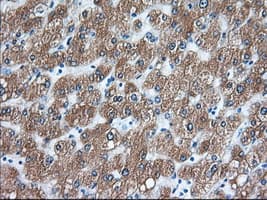 ERIC-1 / TACC3 Antibody (clone OTI7B11)