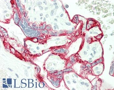 PathPlus™ KRT7 / CK7 / Cytokeratin 7 Antibody (C-Terminus)