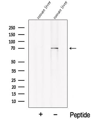 PCK2 / PEPCK Antibody