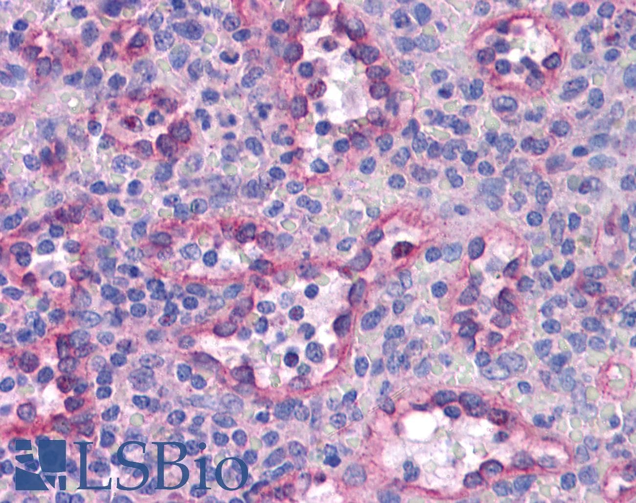 Polyclonal Rabbit anti-Human SREBF2 / SREBP2 Antibody (aa304-353, IHC, WB)