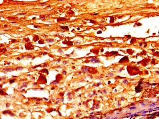 FBN1 / Fibrillin 1 Antibody