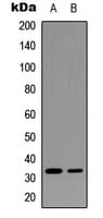 IGFBP3 Antibody (Internal)