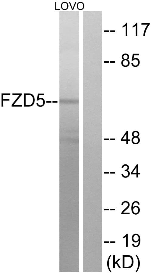 IHC-plus™ Polyclonal Rabbit anti-Human FZD5 / Frizzled 5 Antibody (aa461-510, IHC, IF, WB)