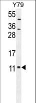 NDUFA11 / B14.7 Antibody (aa64-92)