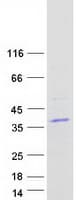 Human LY6G6F Protein (Recombinant Myc-DDK (Flag))