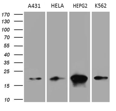 Monoclonal Mouse anti-Human PPIF / Cyclophilin F Antibody (clone OTI7D12, Carrier-free, IHC, WB)