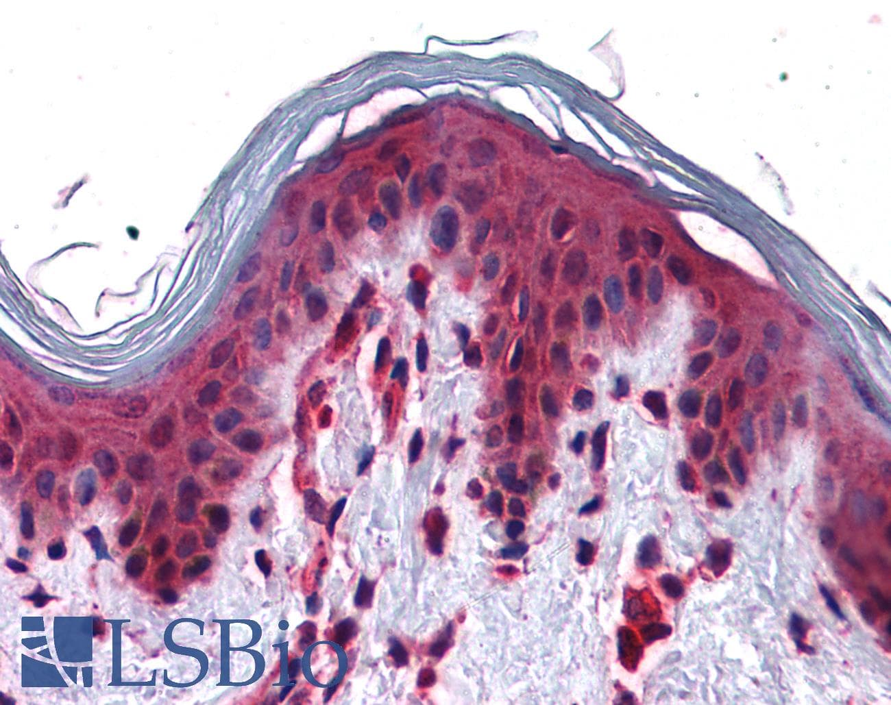 IHC-plus™ SLC5A6 / SMVT Antibody (Internal)