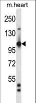 TIE1 / TIE Antibody (aa361-389)