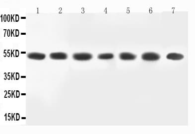 MAP2K2 / MKK2 / MEK2 Antibody (aa2-20)