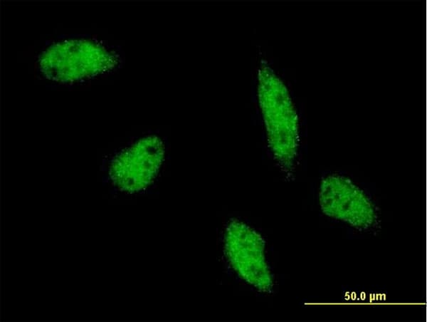 TFAP2B / AP2 Beta Antibody (clone 3G5-1D11)