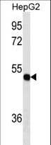 TXNDC5 / ERP46 Antibody (aa128-155)