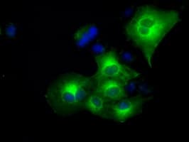 CRYAB / Alpha B Crystallin Antibody (clone OTI1G1)