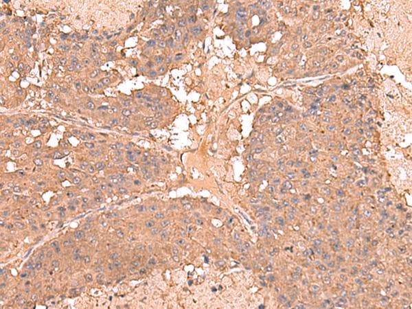 Polyclonal Rabbit anti-Human AHCYL1 / DCAL Antibody (IHC)