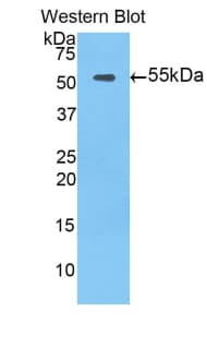 TFPI / LACI Antibody (aa39-275)