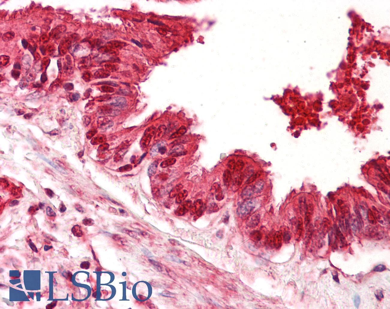 IHC-plus™ TP53 / p53 Antibody (aa344-393)
