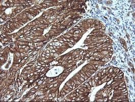MAP2K1 / MKK1 / MEK1 Antibody (clone OTI3B4, Carrier-free)