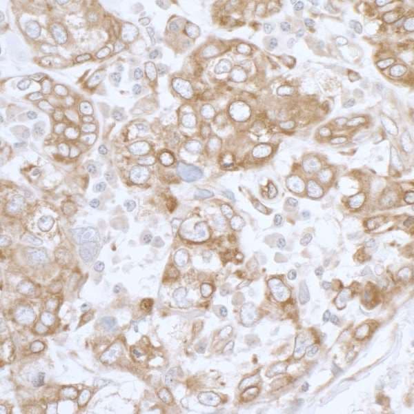 PGRMC1 / MPR Antibody (aa145-195)