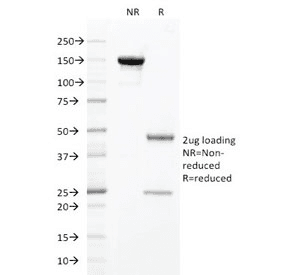 HNF1A / HNF1 Antibody (clone HNF1A/2087)