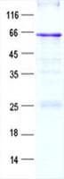 Human ARSI / Arylsulfatase I Protein (Recombinant His, N-Terminal)