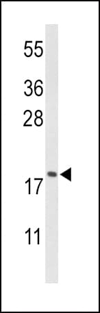 Polyclonal Rabbit anti-Human CFL1 / Cofilin Antibody (aa70-98, WB)