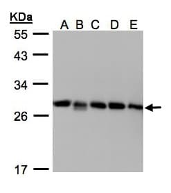 IHC-plus™ GDI2 Antibody