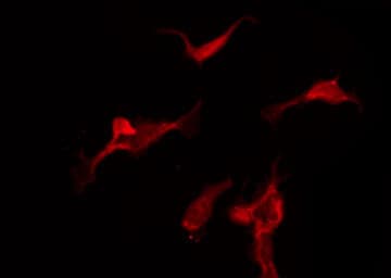 CAMK2A / CaMKII Alpha Antibody (phospho-Thr286)