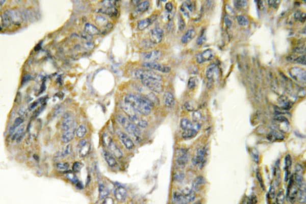 TNF Alpha Antibody (Gln178)