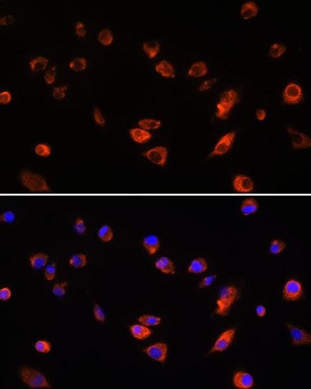 ARL13B Antibody