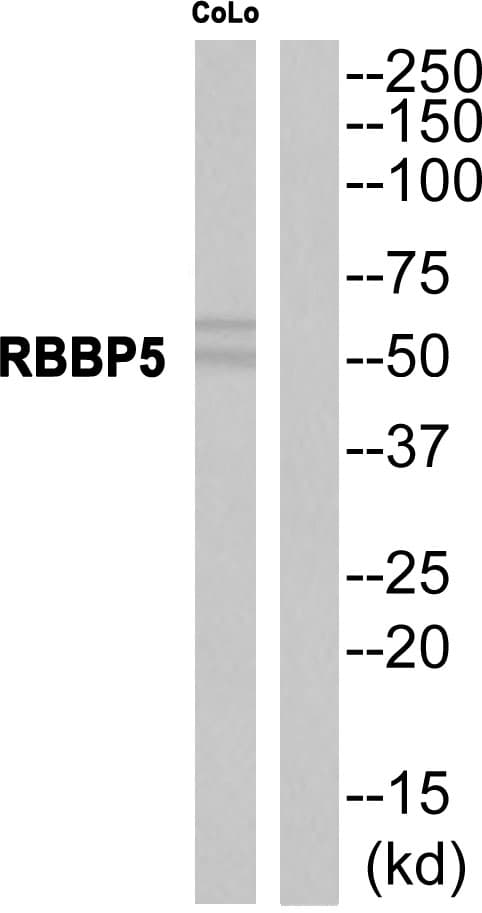 RBBP5 Antibody