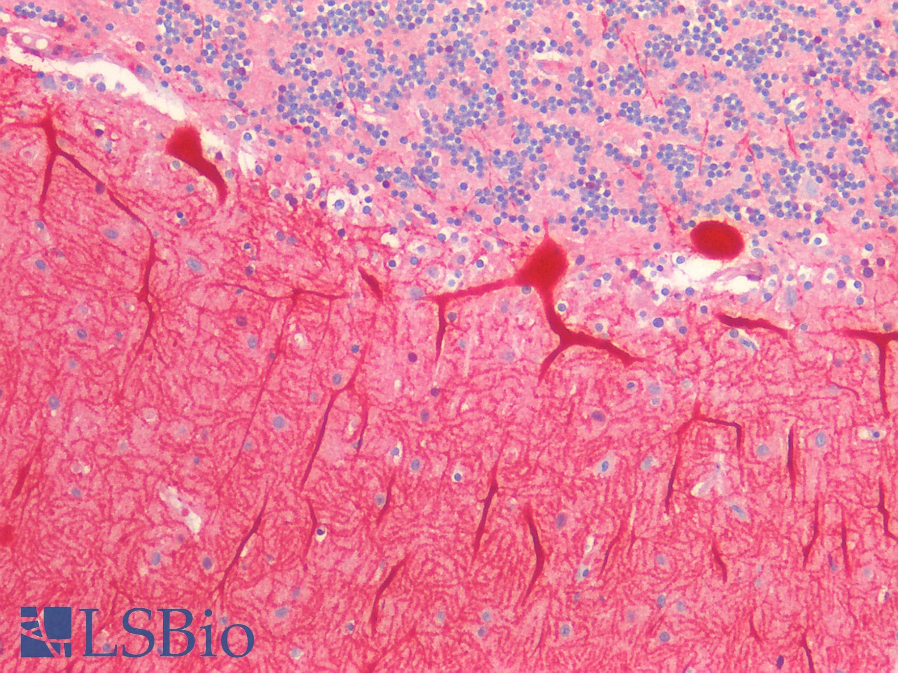 PathPlus™ CALB1 / Calbindin Antibody (aa2-261)