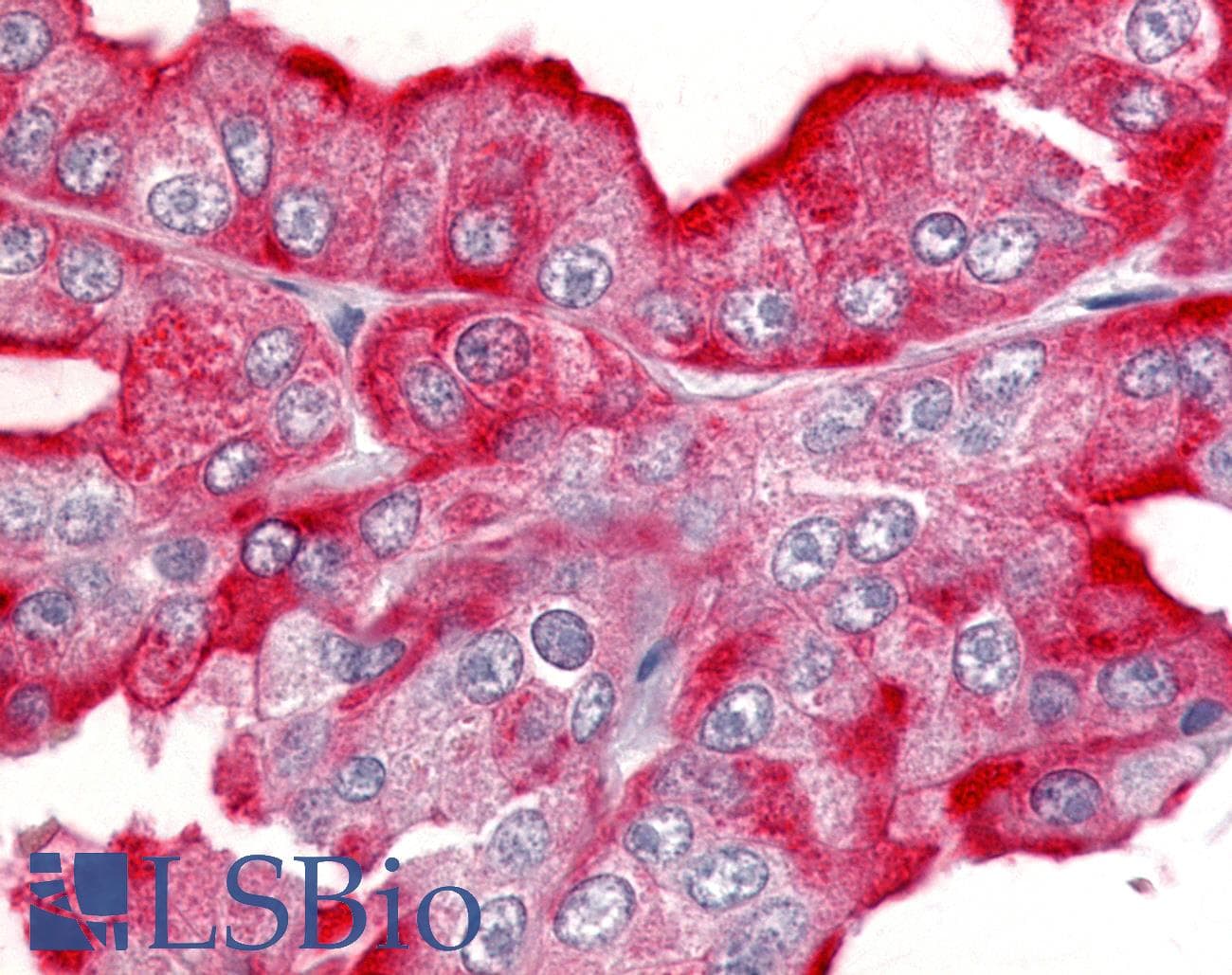 PathPlus™ Polyclonal Rabbit anti-Human CDK12 / CRKRS Antibody (Internal, IHC)