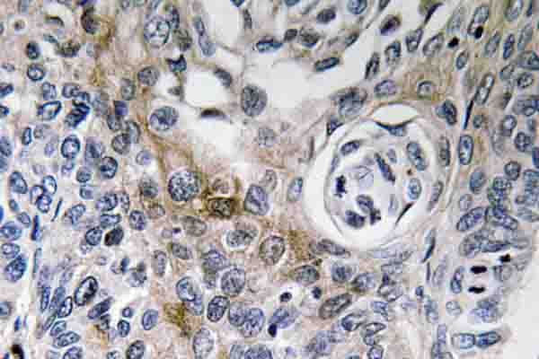 Polyclonal Rabbit anti-Human CD63 Antibody (Lys156, IHC)