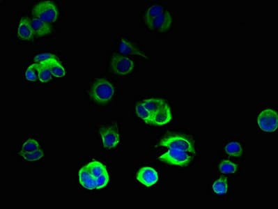 Polyclonal Rabbit anti-Human ORMDL2 Antibody