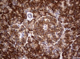 Monoclonal Mouse anti-Human PIK3C2A Antibody (clone OTI15H1, aa230-560, IHC, WB)