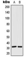 Polyclonal Rabbit anti-Human SIAH1/SIAH2 Antibody (Internal, IHC, IF, WB)