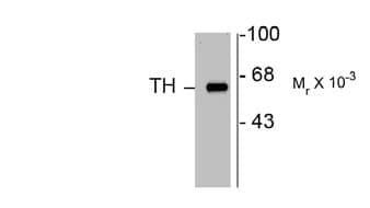 PathPlus™ TH / Tyrosine Hydroxylase Antibody